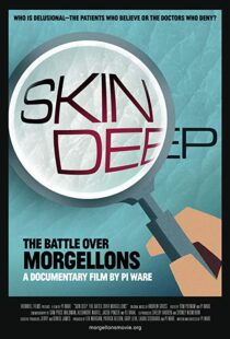 دانلود مستند Skin Deep: The Battle Over Morgellons 2019104233-1241893205